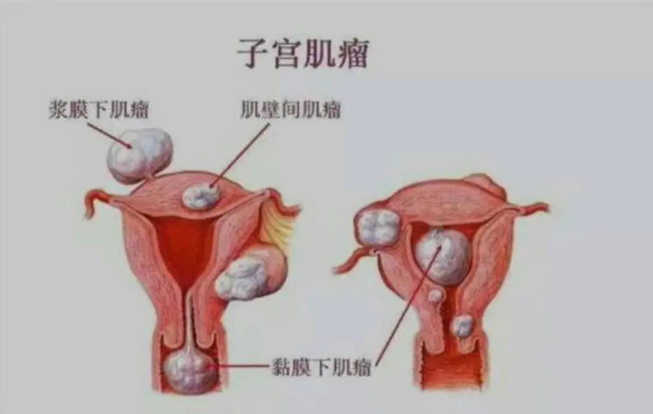 婦科凝膠貼牌