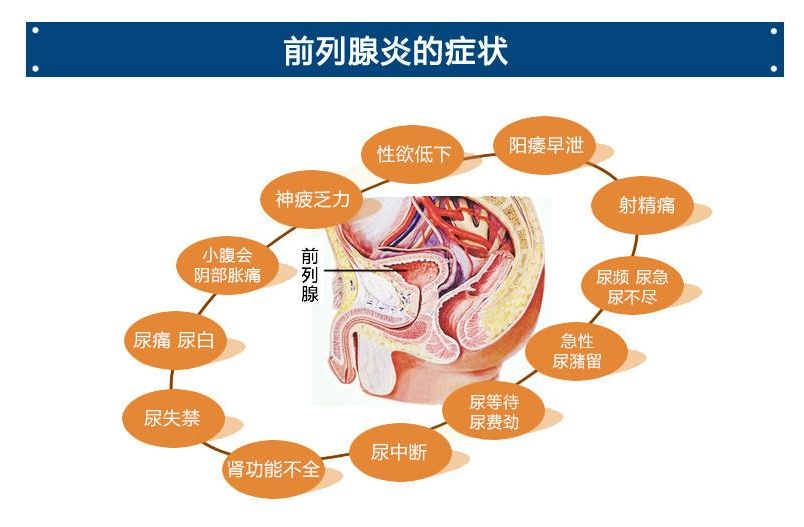 前列腺貼生產廠家