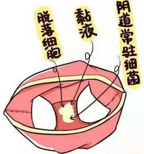 婦科凝膠OEM