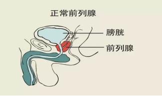 前列腺貼牌廠家