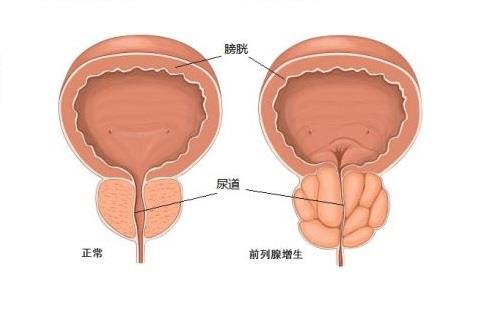 前列腺代加工廠家