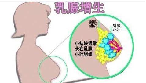 乳腺貼代加工廠家