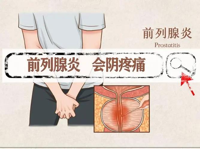 前列腺凝膠貼牌廠家