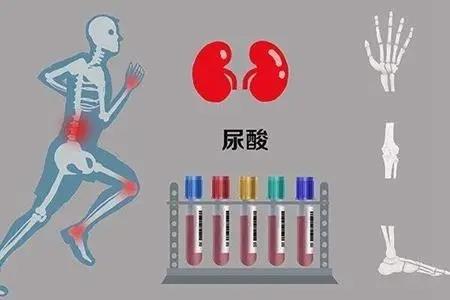 風(fēng)濕噴劑貼牌廠家