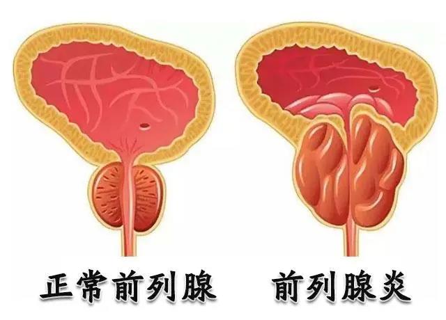 前列腺凝膠OEM廠家