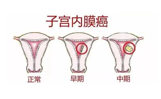 婦科凝膠加工廠家