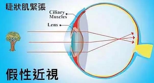 滾珠護(hù)眼膏廠家