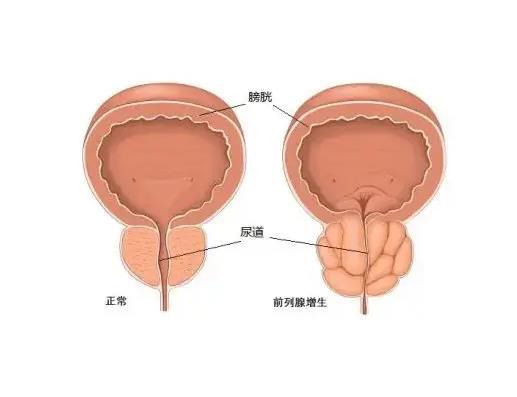 前列腺凝膠oem廠家