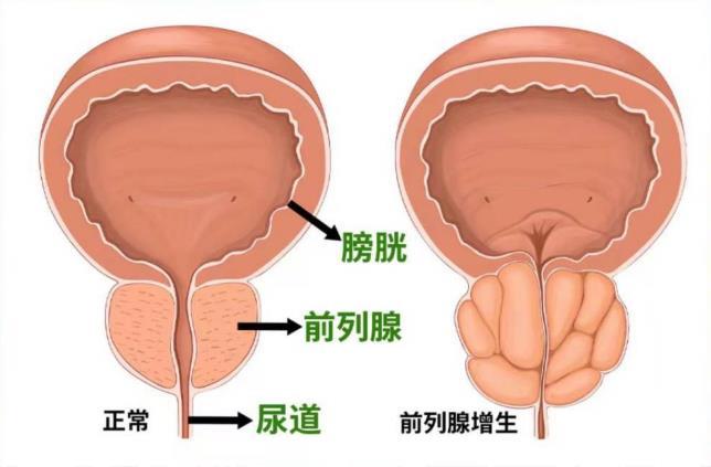 前列腺凝膠OEM廠家